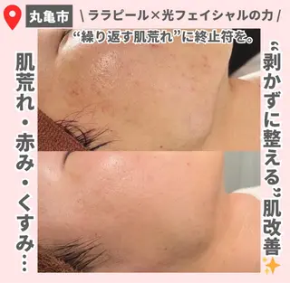 【LEPUS】 sekiのエステ・リラクイメージ