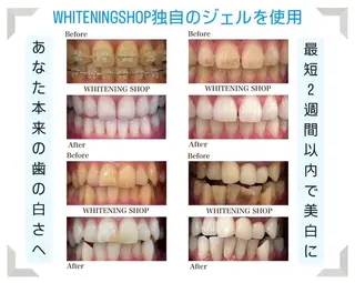 ホワイトニングショップ伊丹店所属・ホワイトニング ショップ伊丹店のその他イメージ