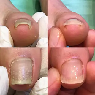 ネイル 東京巻き爪アカデミー所属・東京巻き爪 アカデミーのエステ・リラクイメージ