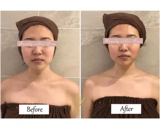 痩身×フェイシャル ブライダル|Linoのエステ・リラクイメージ