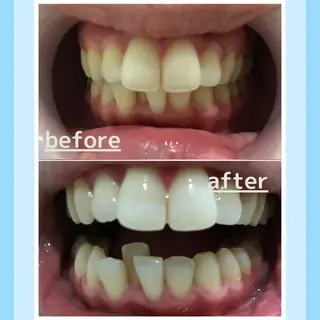 メンズ お手軽ホワイトニングsalon mina所属・武元 奈津美のその他イメージ