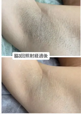 DISINI  SPA所属・DISINISPA 脱毛/フェイシャルのその他イメージ