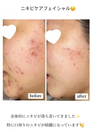 ベラージュ【美背中・ 美尻・フェイシャル】のエステ・リラクイメージ