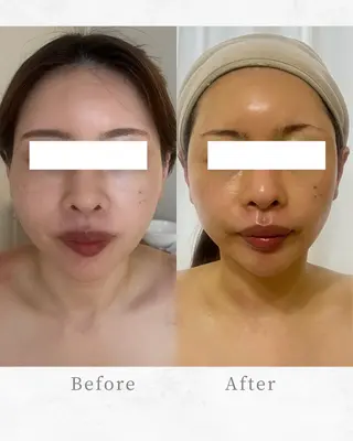 Total Beauty salon Bloom所属・肌育WISHpro 専門サロンBloomのエステ・リラクイメージ