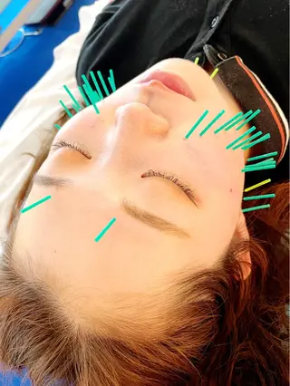 小顔美容鍼専門サロン 渋谷YZのエステ・リラクイメージ