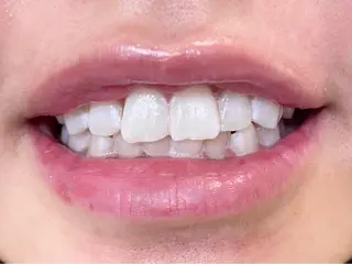 セルフホワイトニングサロン　ラヴィアン所属・ホワイトニングサロン La vie enのその他イメージ