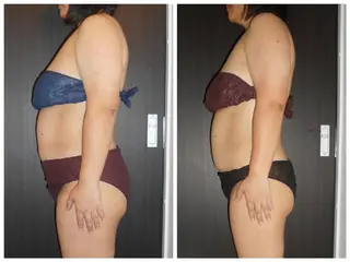 痩身専門店 イオンモール春日部店のエステ・リラクイメージ