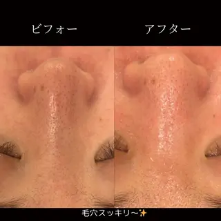 NiU.BEAUTY🥥池袋店所属・ハーブピーリング専門 NiU.BEAUTYのエステ・リラクイメージ