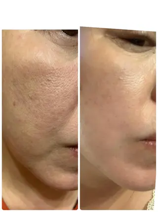 esty hitomiのエステ・リラクイメージ