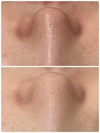来春までに脱・肌荒れ できるサロン✨のエステ・リラクイメージ