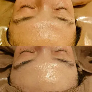 B&H所属・頭痛•肩こり専門/ 眉サロンB&H心斎橋のエステ・リラクイメージ