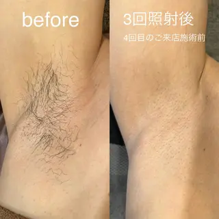 メンズ BEYONDWAX所属・BEYONDWAX ゆうこのエステ・リラクイメージ