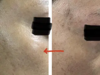 SHINY エステサロンのその他イメージ