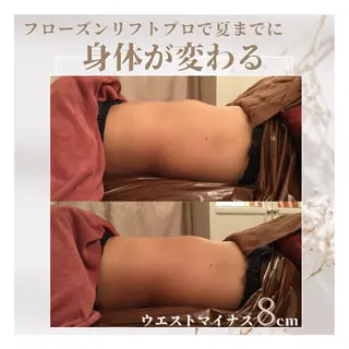 恵比寿インディバ痩身 スーパーバイザー柳澤のエステ・リラクイメージ
