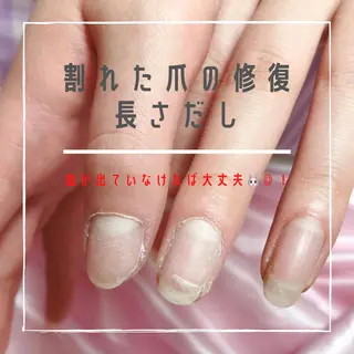 ネイル 深爪を断らない スカルプ高評価店のネイルデザイン
