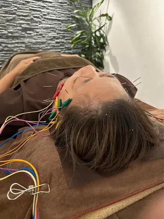 美容鍼灸整体サロンBeauJu所属・小顔矯/美容鍼/鍼灸 BeauJuのその他イメージ