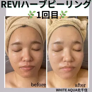 WHITE AQUA 北千住店のエステ・リラクイメージ