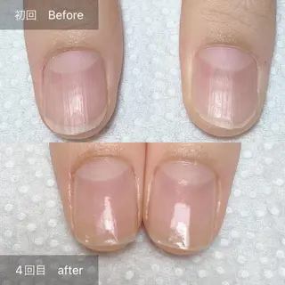 ネイル 木村 千晴のネイルデザイン