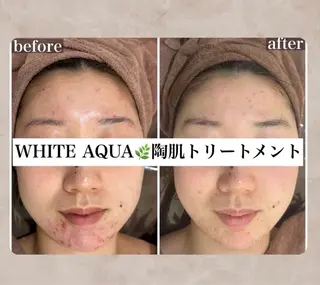 中目黒ハーブピーリン グ🌿ララピールのエステ・リラクイメージ