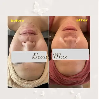 Beauty Maxのエステ・リラクイメージ