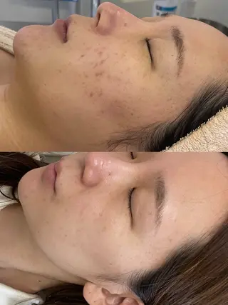 大阪/高槻　salon me.所属・仲原 杏菜のエステ・リラクイメージ