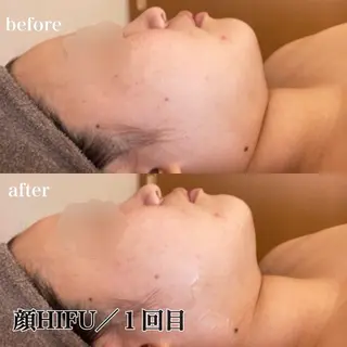 磐田｜LAYLA 一番丁寧な脱毛店のエステ・リラクイメージ