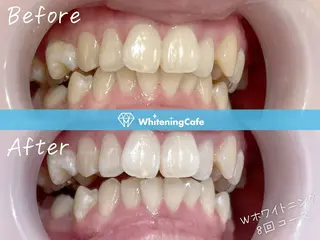 ホワイトニングカフェ原宿店所属・ホワイトニングカフェ 原宿店のエステ・リラクイメージ