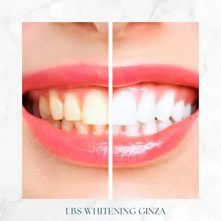 ミディアム メンズ カラー LBSホワイトニング 銀座店💎公式のその他イメージ