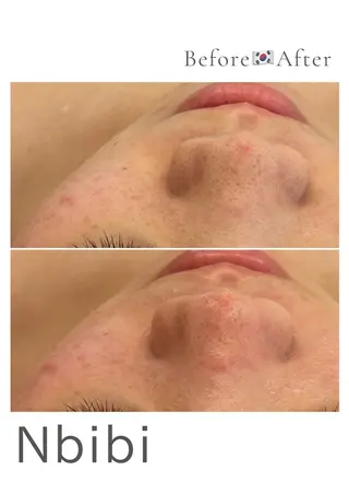 韓国🇰🇷価格 サロン_Nbibiのエステ・リラクイメージ