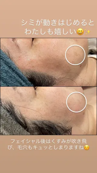 LiZA エステティックサロンのエステ・リラクイメージ