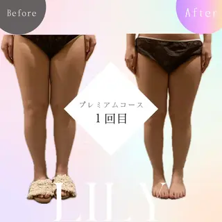 温活痩身サロン ヨサパークリリーのエステ・リラクイメージ