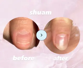 メンズ ネイル 爪ケア/深爪 自爪育成 🐰えむのネイルデザイン