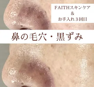 都度払い 肌質改善専門サロンのエステ・リラクイメージ