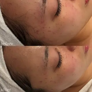 デ・アイム心斎橋所属・肌質改善サロン🫧 MAIのエステ・リラクイメージ