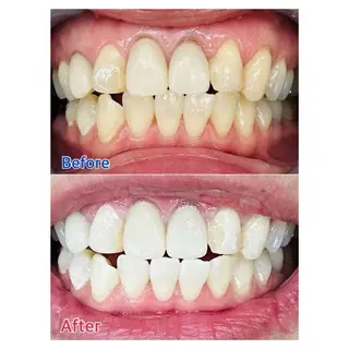 MBEAUTYSALON 千葉店・京成大久保所属・Melty 輝のその他イメージ