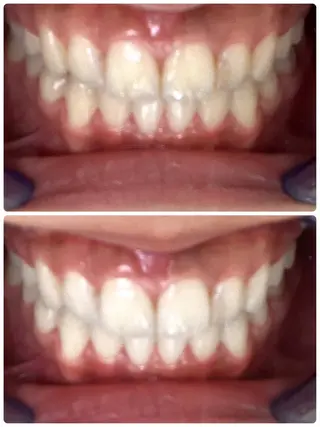 ecxia white 高田馬場所属・セルフホワイトニング エクシア 高田馬場のその他イメージ