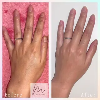 SHARES MADOKAのエステ・リラクイメージ