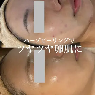 WHITE AQUA 北千住店のエステ・リラクイメージ