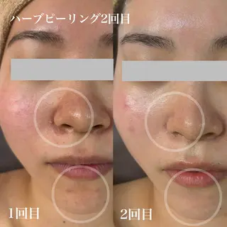 WHITE AQUA 北千住店のエステ・リラクイメージ