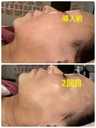 Lien オーナー 山口智嘉のエステ・リラクイメージ