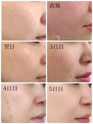 ハーブピーリング専門 BIOPLUS+川崎のエステ・リラクイメージ