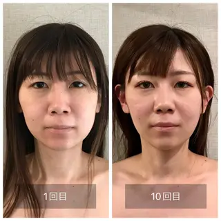 新宿hari-me所属・美容鍼hari-me 新宿のエステ・リラクイメージ