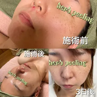 心と華 まさきのエステ・リラクイメージ