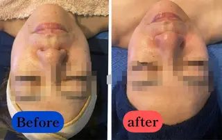 TEIKOKU所属・トータルビューティー TEIKOKUのエステ・リラクイメージ