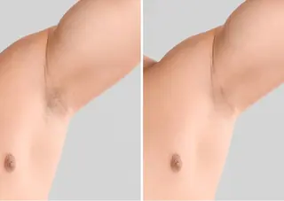 男女兼用脱毛&ドライ ヘッドスパ トレテルのエステ・リラクイメージ