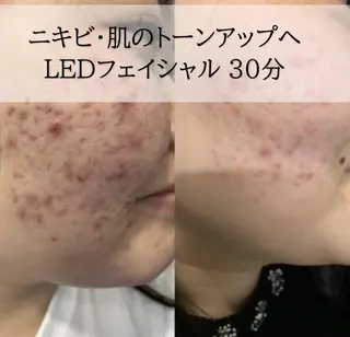 ホワイトニング専門店 LCS 銀座店 峰岡のその他イメージ