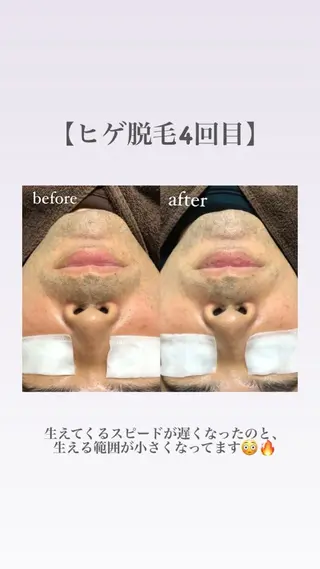 LANA所属・脱毛サロン LANA.のエステ・リラクイメージ