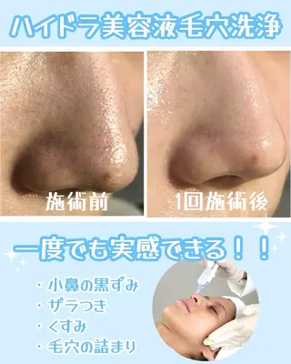 アクア マリンのエステ・リラクイメージ