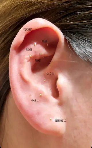 ネイル/耳つぼ /新ホワイトニングのネイルデザイン