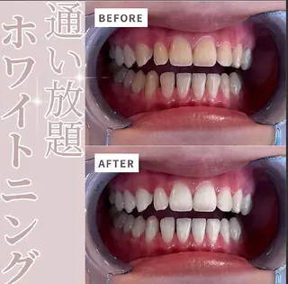 エクシアホワイト 立川南口のエステ・リラクイメージ